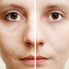 Porevac™ Facial Pore Cleanser - Minaal store