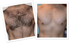 Smooth Body Hair Removal Spray - Minaal store