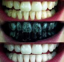 Activated Charcoal Teeth Whitening - Minaal store