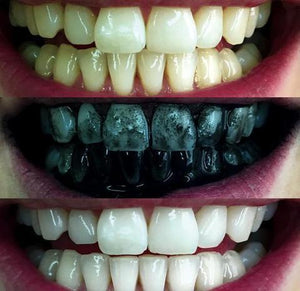 Activated Charcoal Teeth Whitening - Minaal store