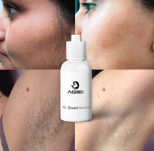 100% Organic Permanent Hair Growth Inhibitor - Minaal store